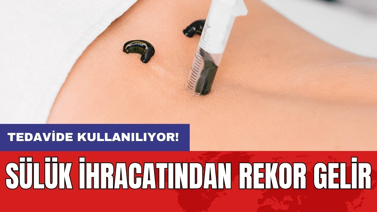 Tedavide kullanılıyor: Sülük ihracatından rekor gelir