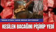 Kesilen Ampute Bacağını Pişirip Yedi