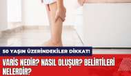 50 yaşın üzerindekiler dikkat! Varis nedir? Nasıl oluşur? Belirtileri nelerdir?