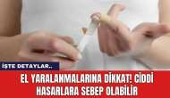 El Yaralanmalarına Dikkat! Ciddi Hasarlara Sebep Olabilir