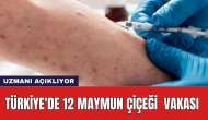 Türkiye'de 12 maymun çiçeği vakası