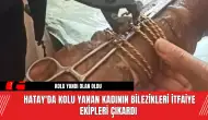 Hatay'da kolu yanan kadının bilezikleri itfaiye ekipleri çıkardı