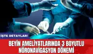 Beyin ameliyatlarında 3 boyutlu nöronavigasyon dönemi