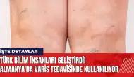 Türk bilim insanları geliştirdi! Almanya'da varis tedavisinde kullanılıyor