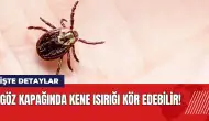 Göz kapağında kene ısırığı kör edebilir!