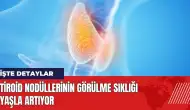 Tiroid nodüllerinin görülme sıklığı yaşla artıyor