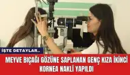 Meyve Bıçağı Gözüne Saplanan Genç Kıza İkinci Kornea Nakli Yapıldı