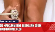 Diz kireçlenmesine bebeklerin göbek kordonu çare oldu