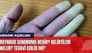 Raynaud Sendromu Nedir? Belirtileir neler? Tedavi edilir mi?