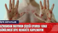 Maymun çiçeği uyarısı: Vaka görülmedi diye rehavete kapılmayın