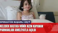 Kelebek hastası minik kızın kapanan parmakları ameliyatla açıldı