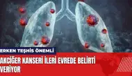 Akciğer kanseri ileri evrede belirti veriyor