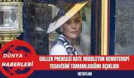 Galler Prensesi Kate Middleton Kemoterapi Tedavisini Tamamladığını Açıkladı