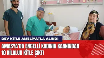 Amasya’da engelli kadının karnından 10 kiloluk kitle çıktı