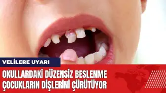 Okullardaki düzensiz beslenme çocukların dişlerini çürütüyor