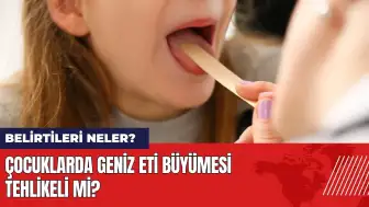 Çocuklarda geniz eti büyümesi tehlikeli mi? Belirtileri neler?