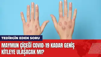 Maymun çiçeği Covid-19 kadar geniş kitleye ulaşacak mı?