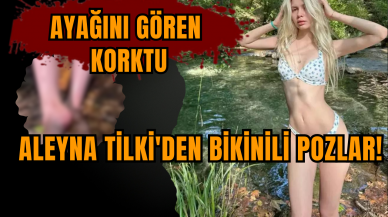 Aleyna Tilki'den bikinili pozlar! Ayağını gören korktu