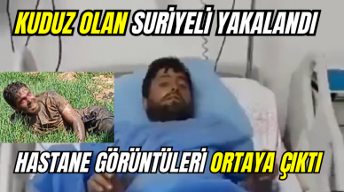 Kuduz olan Suriyeli'nin hastane görüntüleri ortaya çıktı