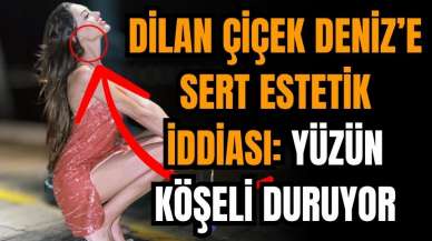 Dilan Çiçek Deniz'e estetik iddiası: Yüzün köşeli duruyor