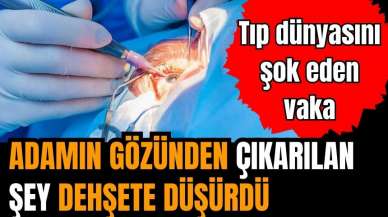 Gözünden çıkartılan şey doktorları şok etti