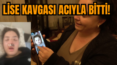 Lise kavgasında 14 yaşındaki öğrencinin burnu kırıldı