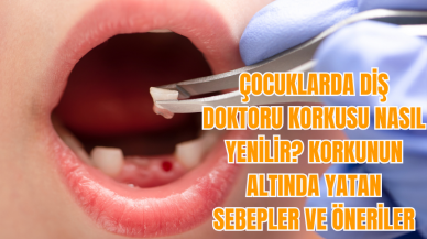 Çocuklarda diş doktoru korkusu nasıl yenilir? Korkunun altında yatan sebepler ve öneriler