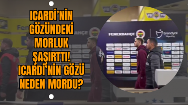 Icardi’nin Gözündeki Morluk Şaşırttı! Icardi’nin Gözü Neden Mordu?