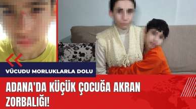 Adana'da küçük çocuğa akran zorbalığı: Vücudu morluklarla dolu