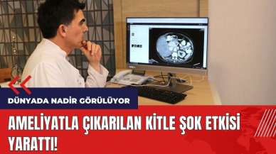 Ameliyatla çıkarılan kitle şok etkisi yarattı