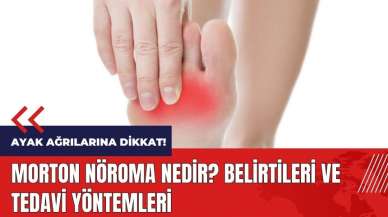 Ayak ağrılarına dikkat! Morton nöroma nedir? Morton nöroma belirtileri ve tedavi yöntemleri