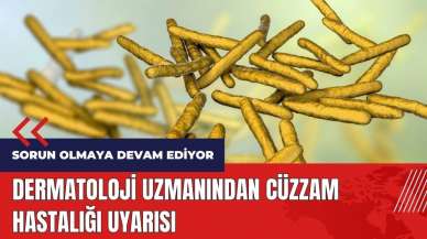 Dermatoloji uzmanından Cüzzam hastalığı uyarısı