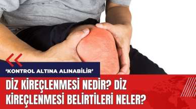 Diz kireçlenmesi nedir? Diz kireçlenmesi belirtileri neler?