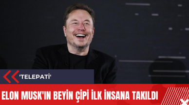 Elon Musk'ın beyin çipi ilk insana takıldı