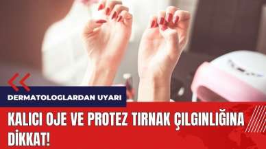 Dermatologlardan uyarı: Kalıcı oje ve protez tırnak çılgınlığına dikkat! 