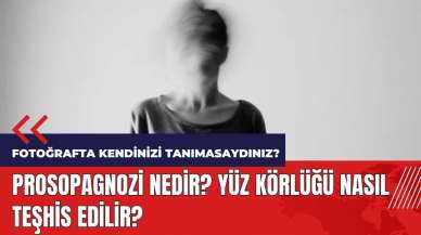 Prosopagnozi nedir? Yüz körlüğü nasıl teşhis edilir?