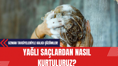 Yağlı Saçlardan Nasıl Kurtuluruz? İşte Uzman Tavsiyeleriyle Yağlı Saç Problemine Kalıcı Çözümler!