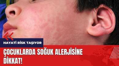 Çocuklarda soğuk alerjisine dikkat! Hayati risk taşıyor