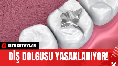 Diş Dolgusu Yasaklanıyor!