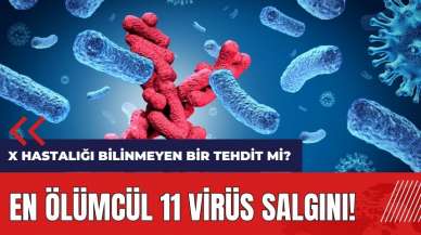 En ölümcül 11 virüs salgını! X Hastalığı bilinmeyen bir tehdit mi?