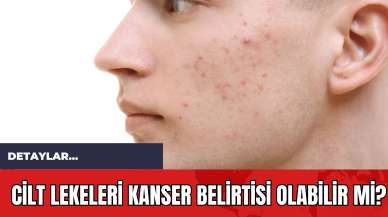 Cilt Lekeleri Kanser Belirtisi Olabilir mi?