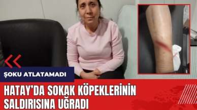 Hatay'da sokak köpeklerinin saldırısına uğradı