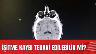 İşitme kaybı tedavi edilebilir mi?