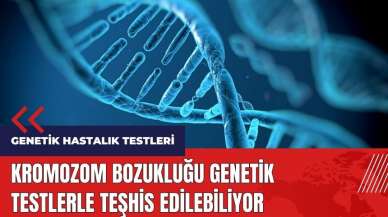 Kromozom bozukluğu genetik testlerle teşhis edilebiliyor