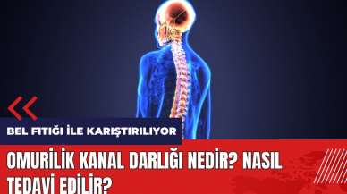 Omurilik Kanal Darlığı nedir? Nasıl tedavi edilir?