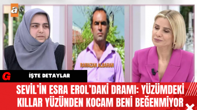 Sevil’in Esra Erol’daki Dramı: Yüzümdeki Kıllar Yüzünden Kocam Beni Beğenmiyor