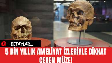 5 Bin Yıllık Ameliyat İzleriyle Dikkat Çeken Müze!