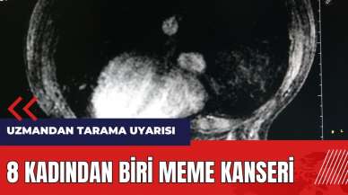 8 kadından biri meme kanseri! Uzmandan tarama uyarısı