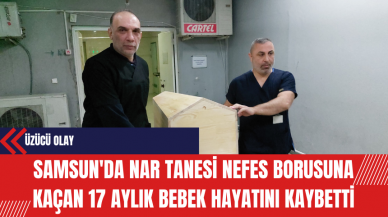 Samsun'da Nar Tanesi Nefes Borusuna Kaçan 17 Aylık Bebek Hayatını Kaybetti