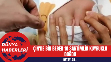 Çin'de Bir Bebek 10 Santimlik Kuyrukla Doğdu